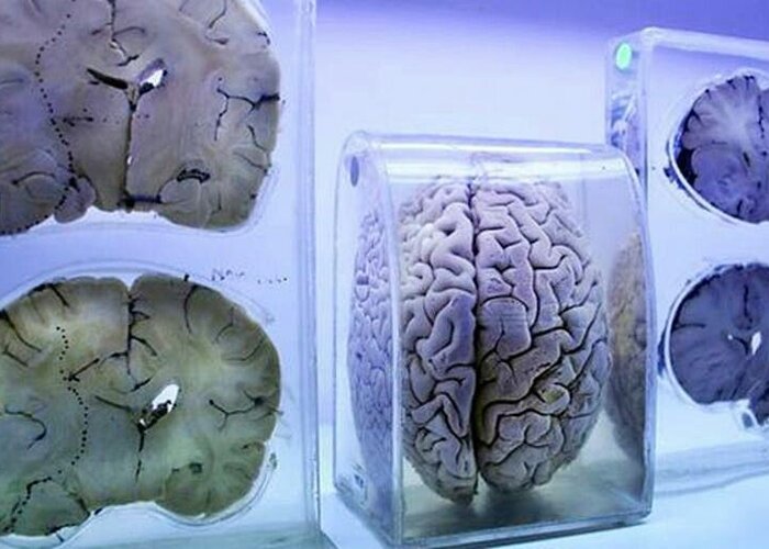 Brain Museum